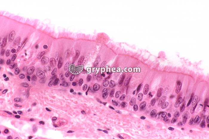 Trachée en CT montrant l'épithélium cilié x170 - gryphea.org